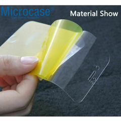 Microcase Xiaomi Mi 15 Pro   Full Ön Arka Kaplama Koruma Filmi - AL3279