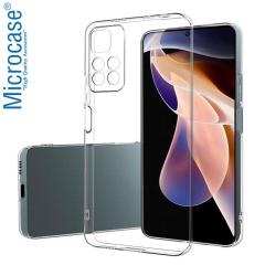 Microcase Xiaomi Redmi Note 11 0.2 mm İnce Silikon Kılıf - Şeffaf