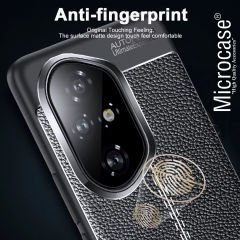 Microcase Honor 300 ile Uyumlu Leather Serisi Deri Efekt Silikon Kılıf - Siyah Al3337
