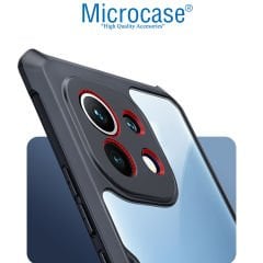 Microcase Xiaomi Mi 11 Lite Airbag Serisi Darbeye Dayanıklı Köşe Korumalı Kılıf