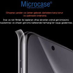 Microcase Xiaomi 17 ile Uyumlu Tpu Arka ve Yan Nano Koruma- EKM115