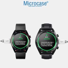 Microcase Honor Watch Magic 2 46 mm Manyetik Şarj Kablosu - AL2822