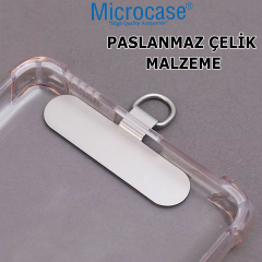 Microcase Telefon İp Askılıklar için Paslanmaz Çelik Tutacak Bağlantı Parçası - AL4832 2 Adet
