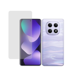 Microcase Xiaomi Redmi Note 15 Full Ön Kaplama Koruma Filmi - AL3280