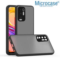 Microcase Oppo Reno 5 Pro Plus London Serisi Kılıf - Buzlu Siyah