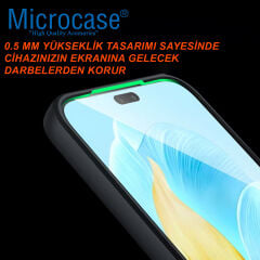 Microcase Xiaomi 17T Pro ile uyumlu Magsafe Uyumlu Mat Yüzey Kılıf AL4967