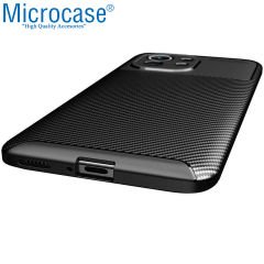 Microcase Xiaomi Mi 11 Ultra Maxy Serisi Carbon Fiber Silikon Kılıf - Siyah AL3413