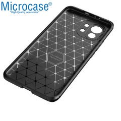 Microcase Xiaomi Mi 11 Ultra Maxy Serisi Carbon Fiber Silikon Kılıf - Siyah AL3413