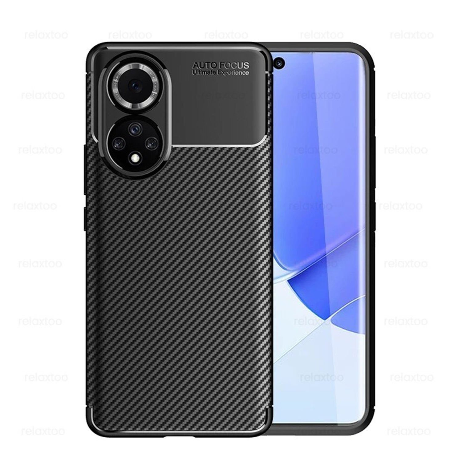 Microcase Huawei Nova 9 Maxy Serisi Carbon Fiber Silikon Kılıf - Siyah AL3413