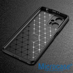Microcase Xiaomi Redmi Note 11T /Xiaomi Redmi Note 11T Pro/Poco X4 GT Maxy Serisi Carbon Fiber Silikon Kılıf - Siyah AL3413