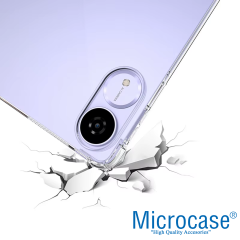 Microcase Honor Pad V9 11.5 inch Tablet Silikon Tpu Soft Kılıf -AL3284