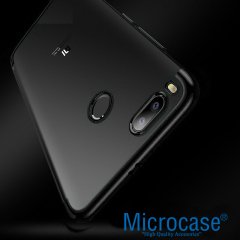 Xiaomi Mi 5X - Mi A1 Plating Series Soft Silikon Kılıf + CAM