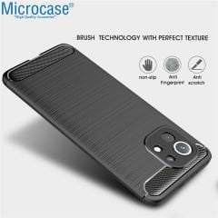 Microcase Xiaomi Mi 11 Lite Brushed Carbon Fiber Silikon Kılıf - Siyah