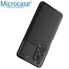 Microcase Huawei Nova 9 SE Maxy Serisi Carbon Fiber Silikon TPU Kılıf - Siyah