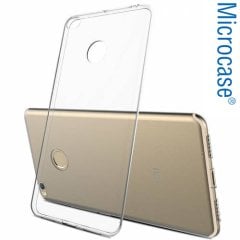 Microcase Xiaomi Mi Max 2 İnce Silikon Kılıf + Tam Kaplayan Cam