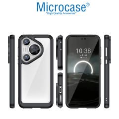 Microcase Huawei Pura 70 Pro  Shield Serisi Darbeye Dayanıklı Yarı Esnek Plastik Tpu Kılıf - AL8100