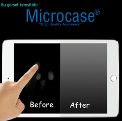 Microcase Huawei MatePad SE 11 2024  Tablet Nano Esnek Anti Glare MAT Ekran Koruma Filmi - AL3288