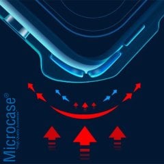 Microcase Xiaomi Redmi Note 11 Pro 4G (Global) Airbag Serisi Darbeye Dayanıklı Köşe Korumalı Kılıf