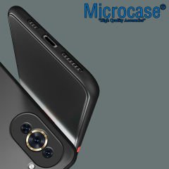 Microcase Huawei Nova 10 Pro London Serisi Darbeye Dayanıklı Kılıf - Buzlu Siyah AL3415