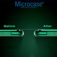 Microcase Huawei P40 Lite Kamera Camı Lens Koruyucu
