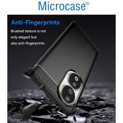 Microcase Honor 90 için Brushed Carbon Fiber Silikon Kılıf - Siyah AL3332