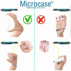 Microcase Xiaomi 14 Global  Ceramic Nano Tam Kaplayan Ekran Koruma-AL3274