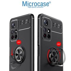 Microcase Xiaomi Redmi Note 11 Focus Serisi Yüzüklü Kılıf - Siyah