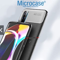 Microcase Xiaomi Mi 10 Pro Maxy Serisi Carbon Fiber Silikon TPU Kılıf - Siyah