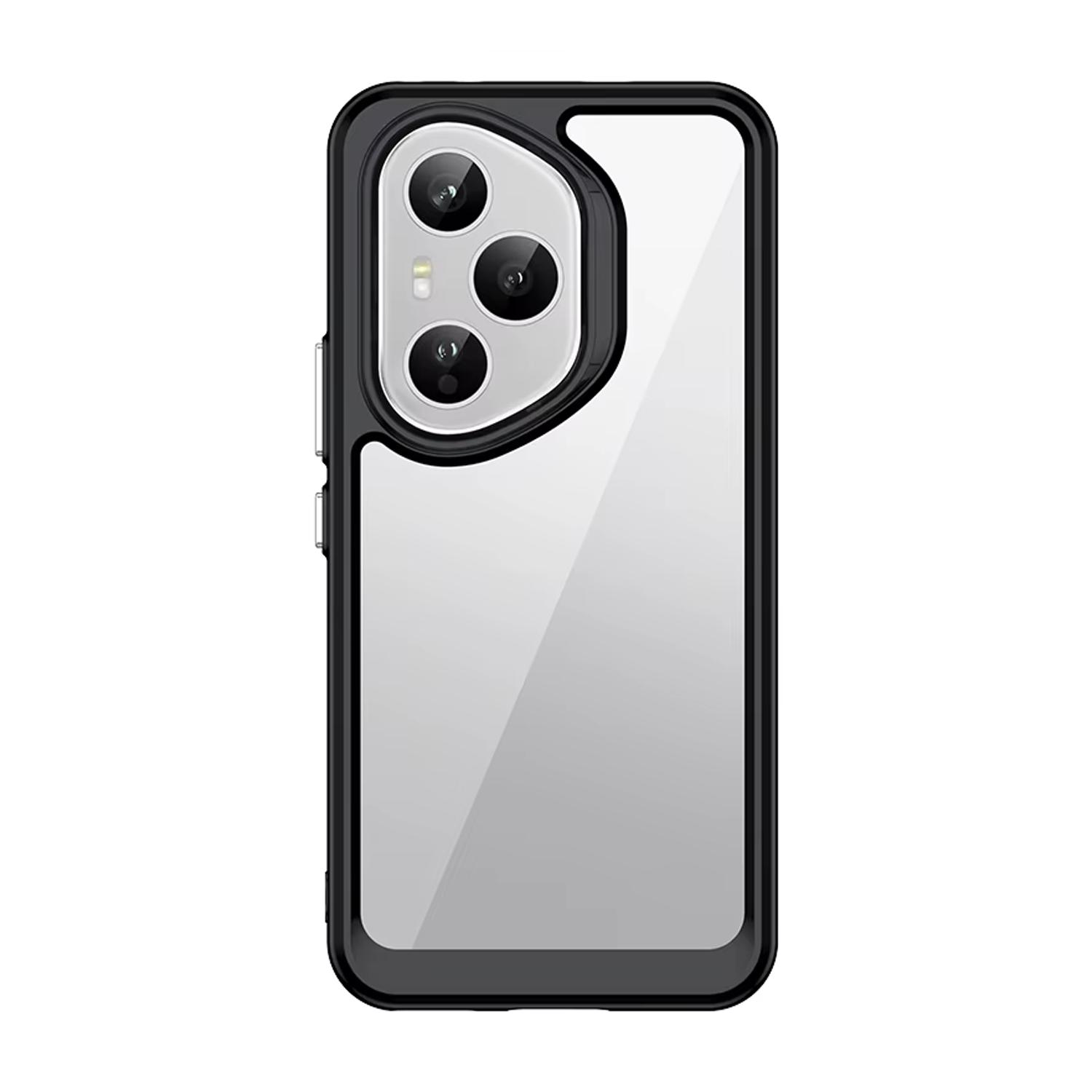 Microcase Honor 400 Pro 5G Shield Serisi Darbeye Dayanıklı Yarı Esnek Plastik Tpu Kılıf - AL8100