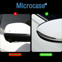 Microcase Universal Esnek Ayna ve Kapı Kenar Çizilme Önleyici Koruyucu Seti 4Lü AL5360