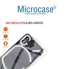 Microcase Nothing Phone 1 Slim Serisi Soft TPU Silikon Kılıf - Şeffaf AL3324
