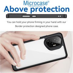 Microcase Honor 300 Shield Serisi Darbeye Dayanıklı Yarı Esnek Plastik Tpu Kılıf - AL8100